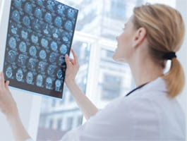 Neurologo Fornovo Visita Neurologica